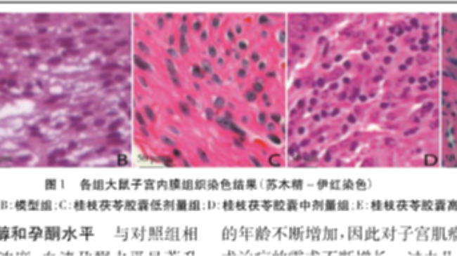 桂枝茯苓胶囊对子宫肌瘤大鼠子宫系数和激素水平的影响相关机制研究