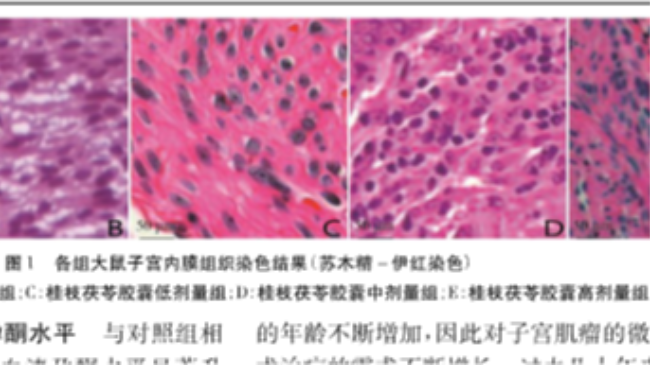 叶智慧团队在《临床和实验医学杂志》发表桂枝茯苓胶囊治疗子宫肌瘤机制研究论文