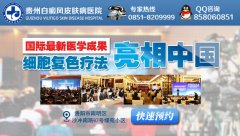 医学论文发表收费标准贵阳白斑病专科医院 贵阳白癜治疗多少费用